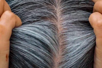 The premature graying problem has a solution